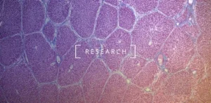 Onderzoek: De rol van NMN bij het herstel van de levergezondheid bij veroudering