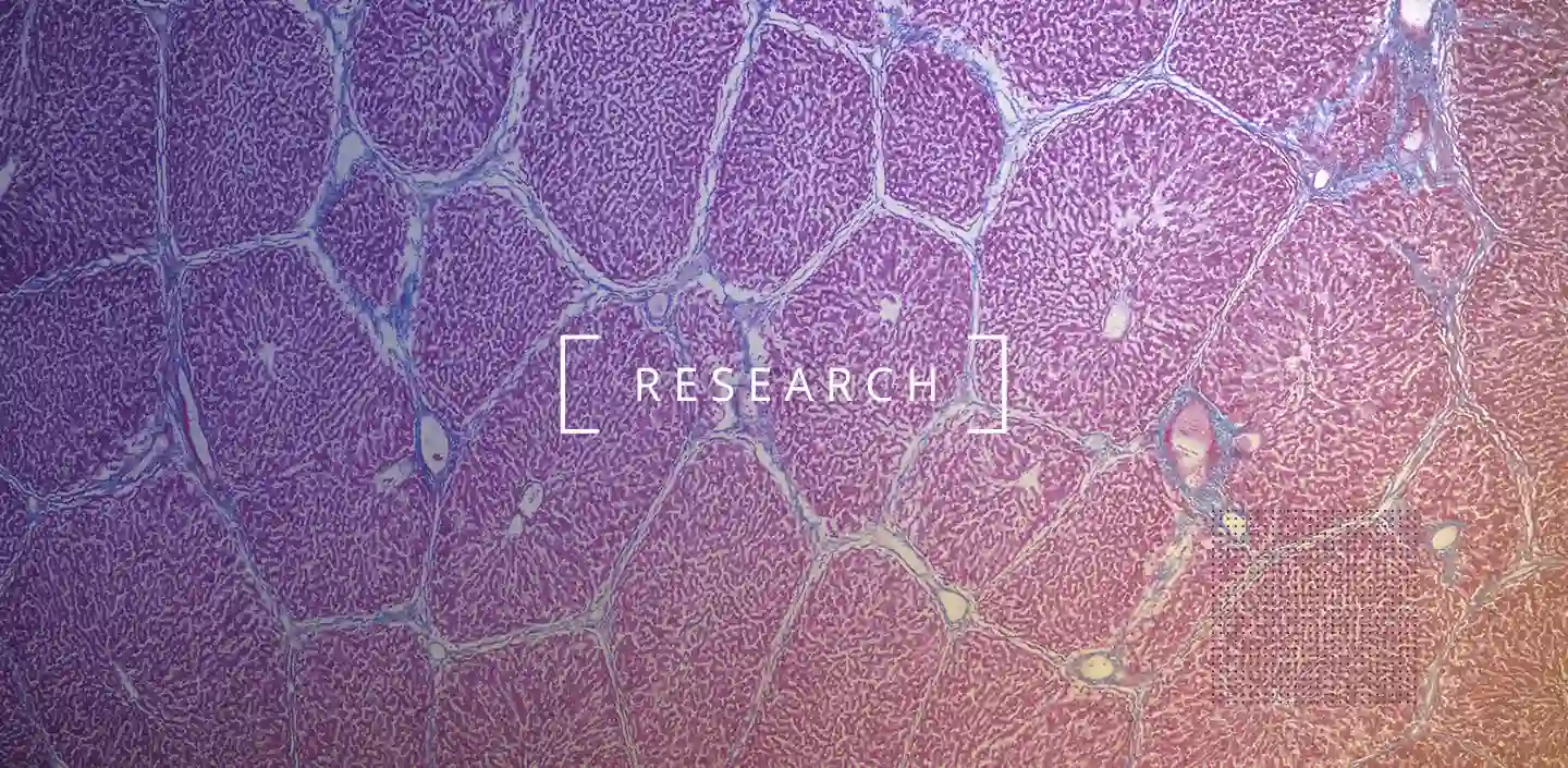 Ontdek hoe NMN verouderingsgerelateerde leverproblemen bestrijdt door oxidatieve stress te verminderen en de veerkracht van de lever te verbeteren via de Sirt3-Nrf2-as.